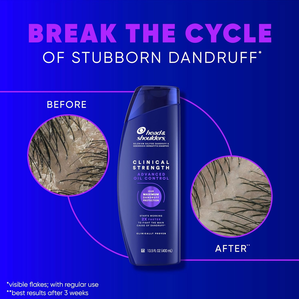 HS Clinical Dandruff Defense Advanced Oil Control 400 ml