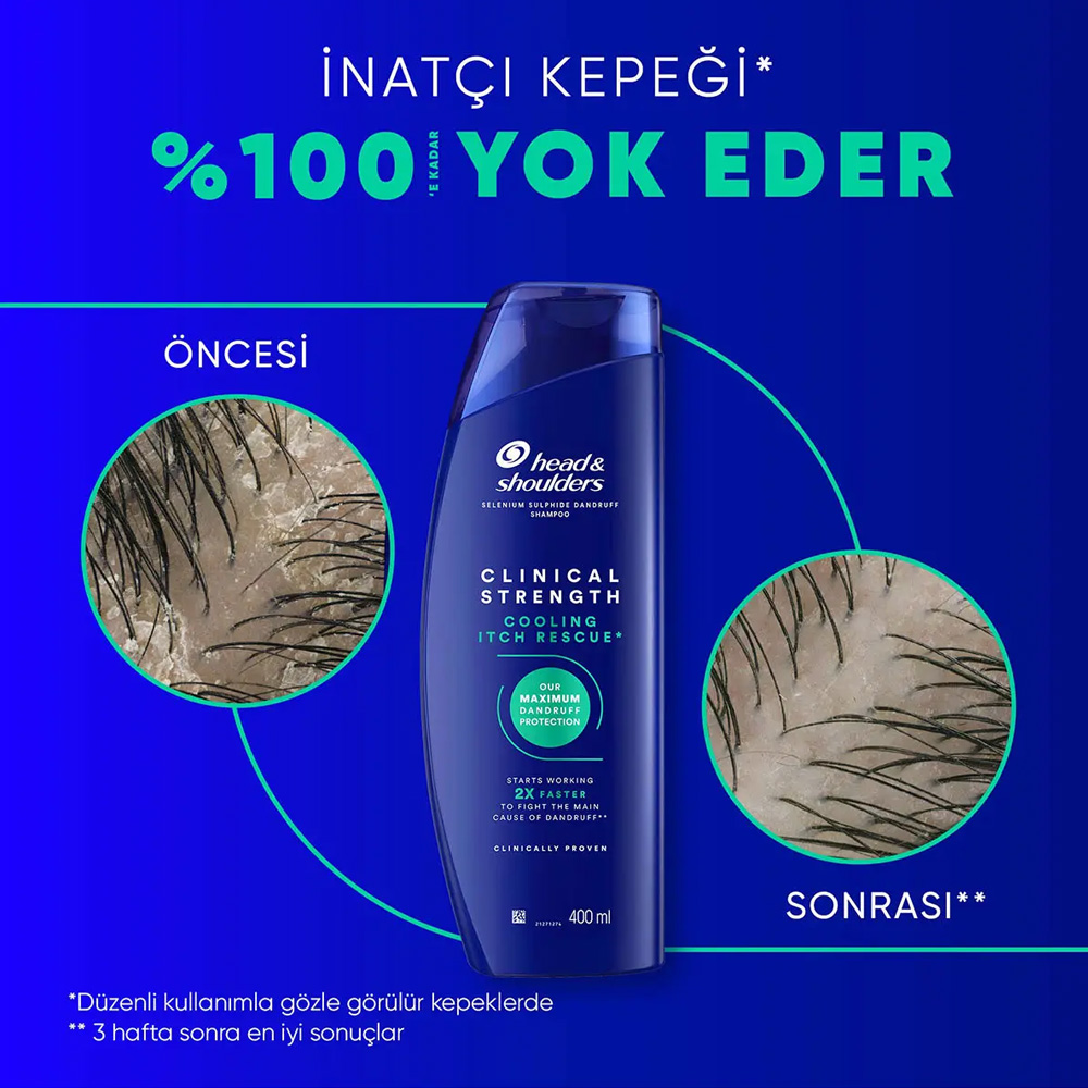 HS Clinical Dandruff Cooling Itch Relief 400 ml